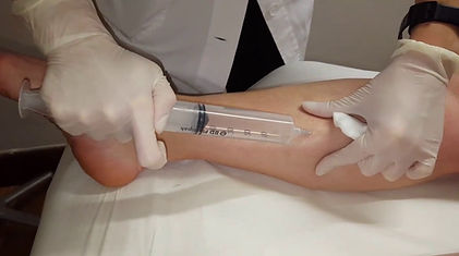 OSSIGENO TERAPIA CELLULITE MILANO