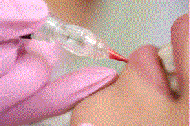 Lips.GIF