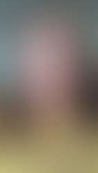 What EXACTLY is Spina Bifida?