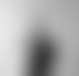 My ABI And I : For Better Or For Worse, Til Death Do Us Apart