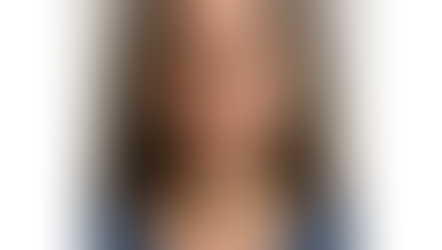 Boosting Bell’s Palsy Recovery with Acupuncture