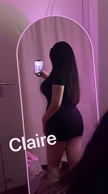20 yo