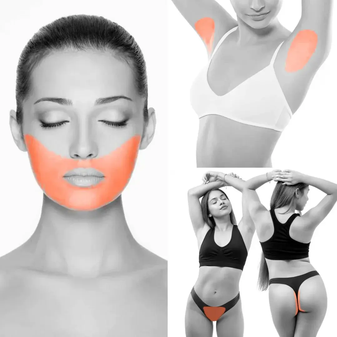 Full Face, Brazilian, Underarms - 6 Sessions