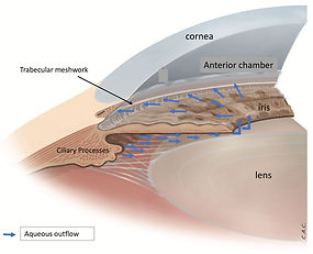 glaucoma-Clarity-oftalmologos-ojos-vision-glaucoma-retina-oftalmologia