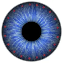 glaucoma-Clarity-oftalmologos-ojos-vision-glaucoma-retina-oftalmologia
