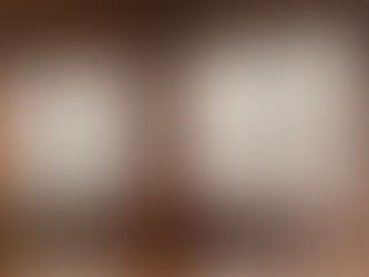 「産後の不調/片頭痛」