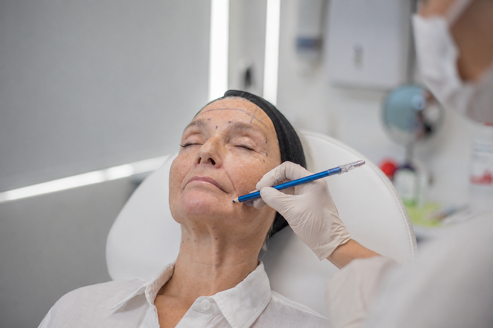 Procedimiento Botox.png