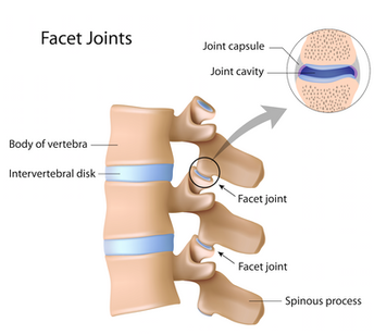 Degenerative Disc Disease -DDD