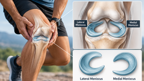 Part 1: Understanding Meniscus Injuries