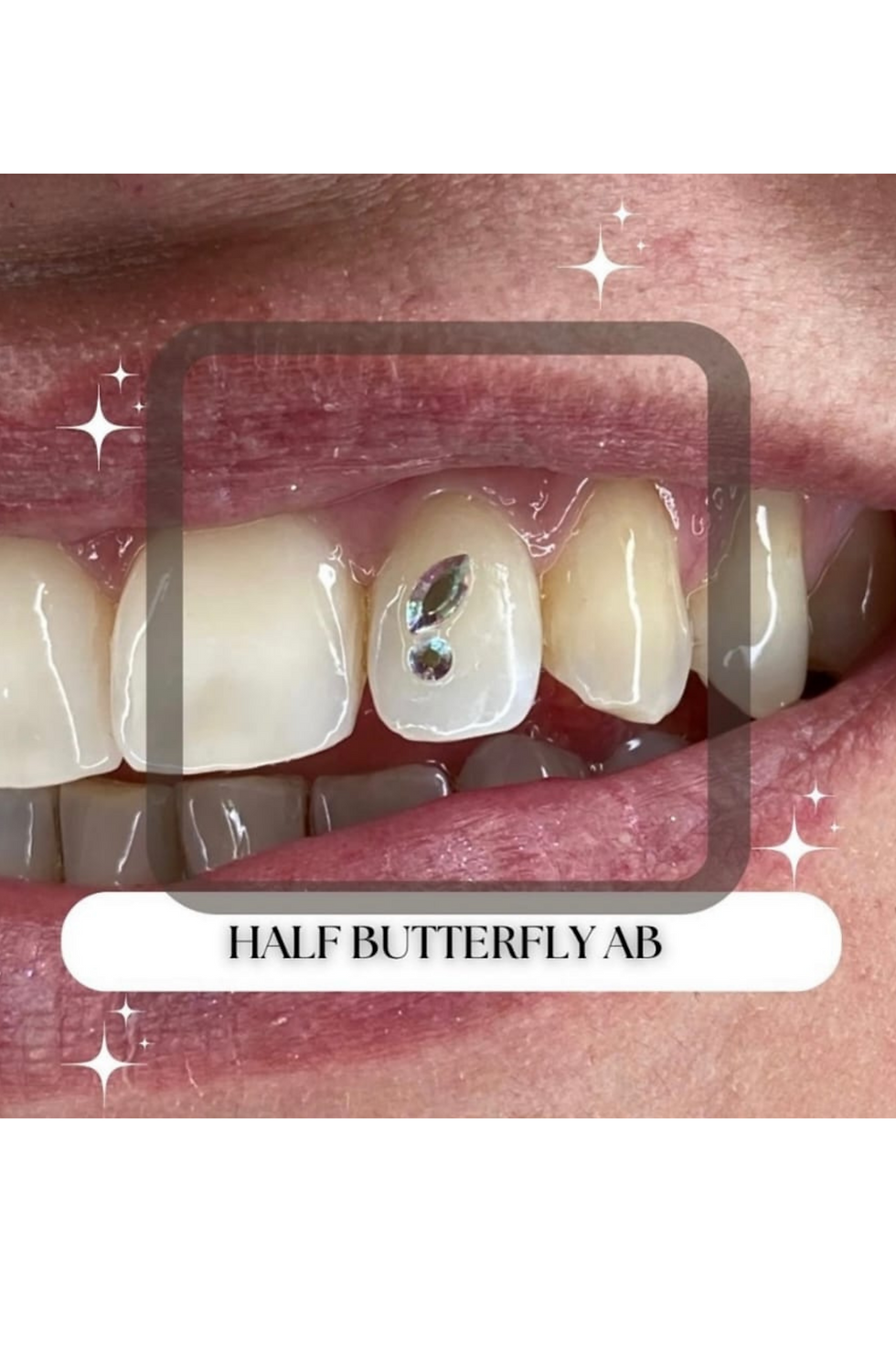 Foto Tattoo Piercing Dermo Seabird gemme dentali