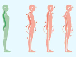why posture is important