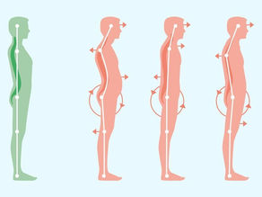 why posture is important