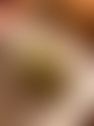 Capesante al Riesling di Gualtiero Marchesi