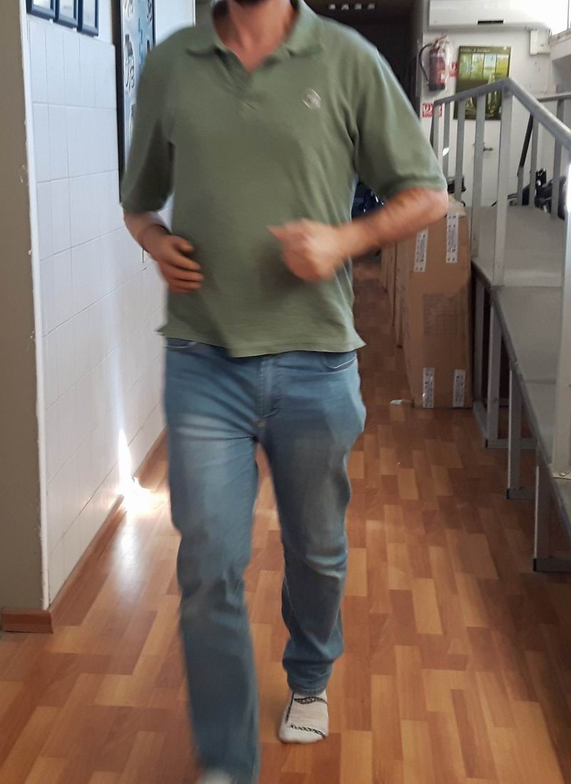 פרוטזת יד לקטיעה מעל למרפק עבור אצן מרתו