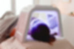 Lichttherapie nach Microneedling im HautRaum Bruchsal
