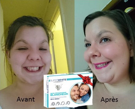Test avant après programme blancheur superwhite, avis blog