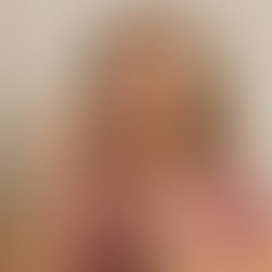 Essential Vitamins for Arthritis Relief