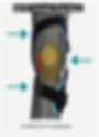 Thumbnail: unloader knee brace