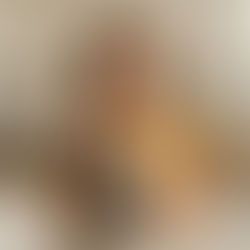 Arthritis in Hands: Symptoms, Relief, and Treatments