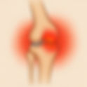 Joint Flare Ups: Causes, Symptoms, and Quick Relief