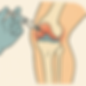 Managing Discomfort After Gel Knee Injections