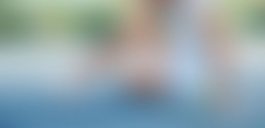 Benefits of Using an Achilles Tendonitis Brace