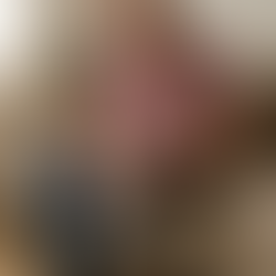 Knee Replacement Recovery Time for Elderly