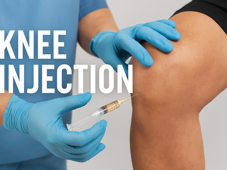 Why You Need a Knee Brace After Exosome Treatment for Knee Osteoarthritis