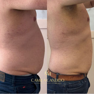 Plano Vita de Emagrecimento em Campo Grande