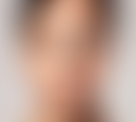 Bioestimulador de Colágeno