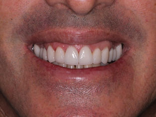 Um Novo Sorriso pra Você