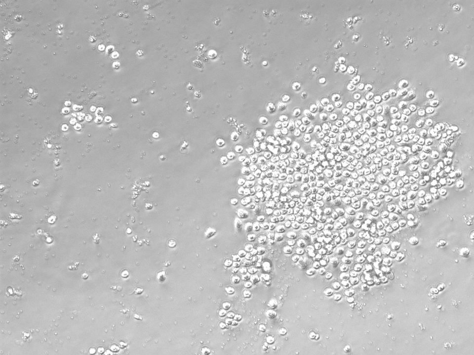 Brightfield microscopy image of isolated, round-shaped alveolar macrophages forming a dense cluster on the right side of the field, surrounded by dispersed cells and smaller clusters throughout the remaining area.