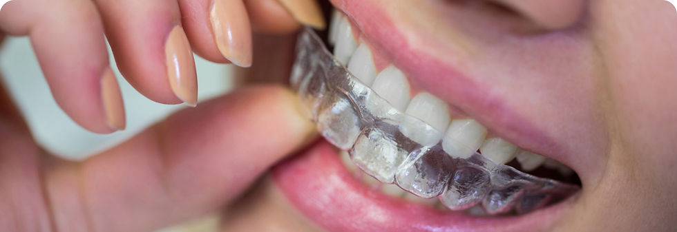 Braces (Orthodontics).jpg