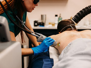 Person in blue gloves using a laser device on a man's back in a clinic, with bottles in the background. Calm atmosphere and focused action. The Parlour in Miami for laser hair removal for men and women using the Candela GentleMax Pro.