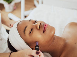 A person receives a microneedling treatment with a wand in a spa setting. They wear a white headband and appear relaxed. Background is softly blurred.