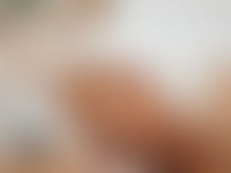 A person receives a microneedling treatment with a wand in a spa setting. They wear a white headband and appear relaxed. Background is softly blurred.