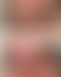 before and after of a lash lift with tint in Miami using Elleebana lash lift products