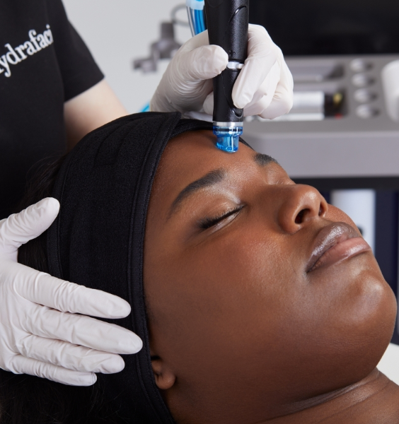 Person receiving a Hydrafacial facial treatment with a hydradermabrasion device. Gloves are worn by the practitioner, a medical esthetician. Relaxed setting in a medical spa, person appears calm.