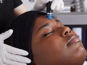 A Hydrafacial