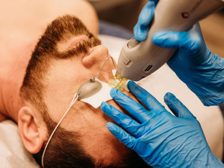 Why More Men Are Choosing Laser Hair Removal — and Loving the Results