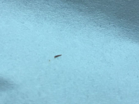 What's Under Your Skin?