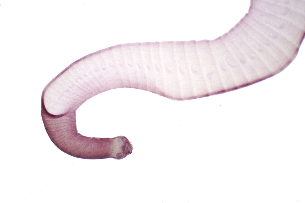 Tapeworm (Parasitic flatworm) of cattle and other grazing animals under the microscope for