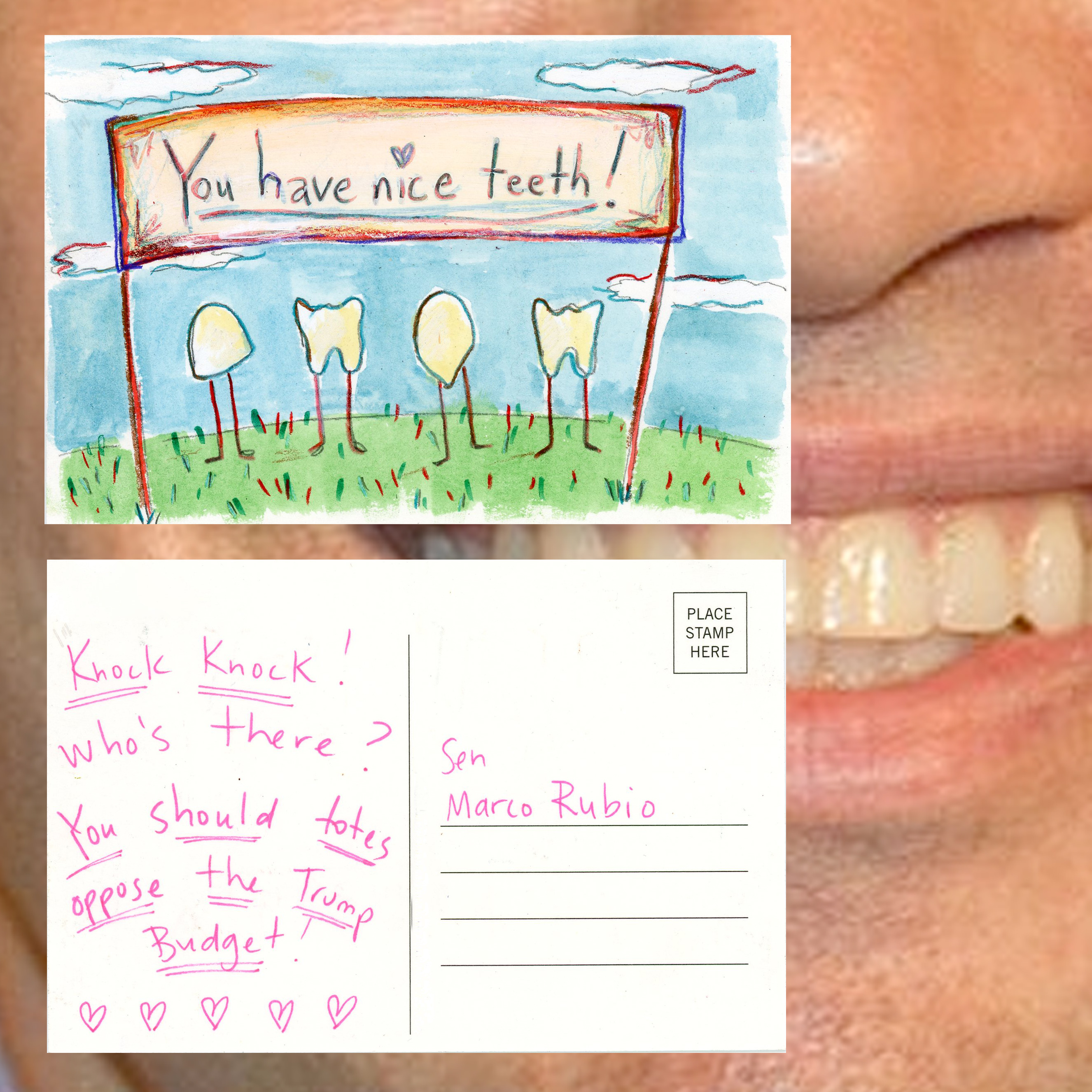 TEETH