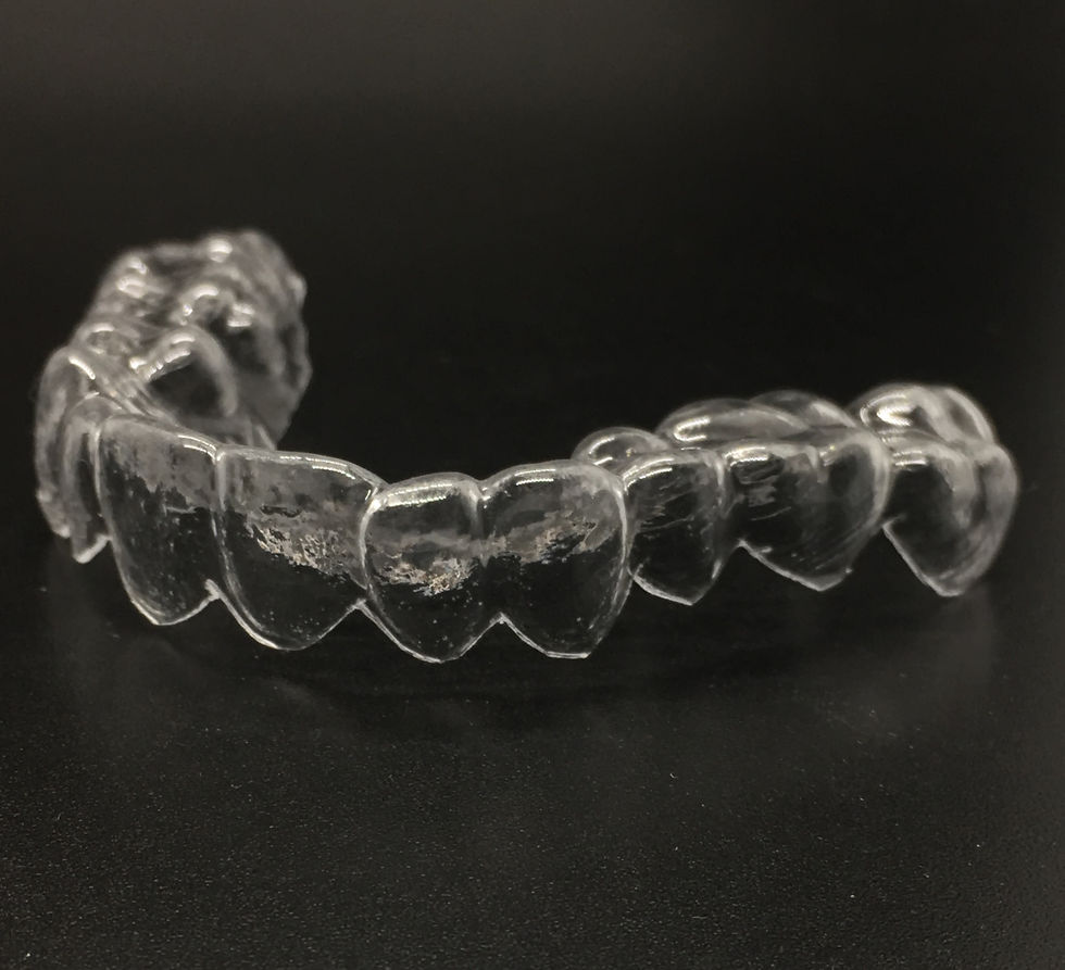 Clear Aligners