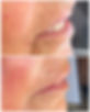 Buccal results flourish and joy.JPG