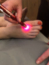 Laser foot.jpeg
