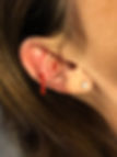 acu ear.jpeg