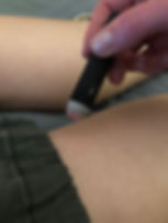 moxa leg.jpeg