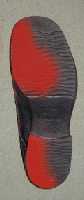 היפרפרונציה Hyperpronation