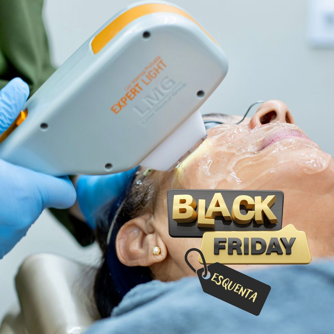 Luz Intensa Pulsada com PDRN - Sessão